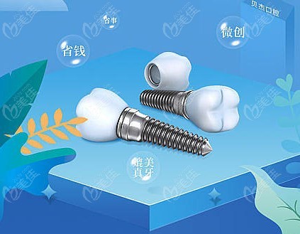 南京浦口口腔科种植牙价格表