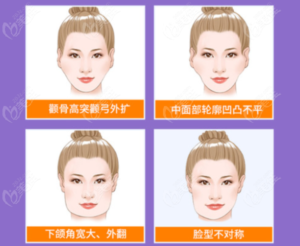 成都友谊医院<!--<i data=20240703-sp></i>-->和李继华医生磨骨怎么样