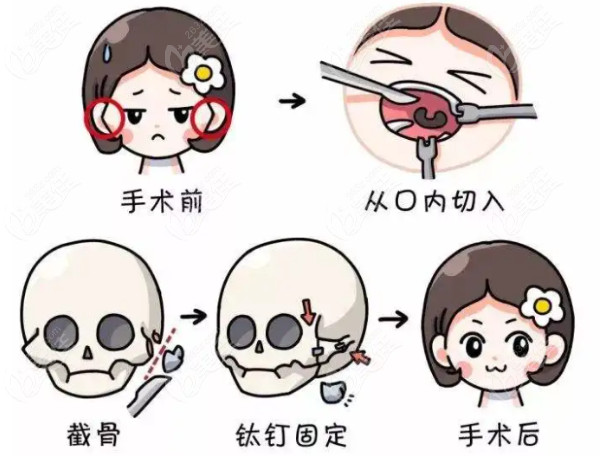 成都十大磨骨医生排名榜