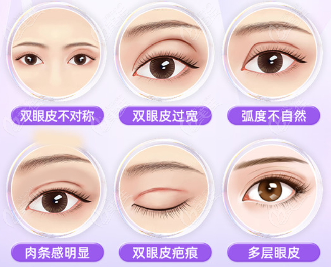 韩国来丽整形医院双眼皮修复怎么样