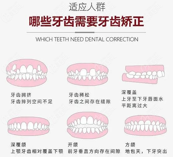 北京西城区牙齿矫正医院哪家好