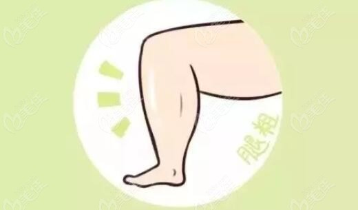 大腿太粗抽脂亲身经历