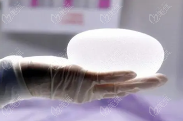 曼托魅力版系列假体隆胸价格