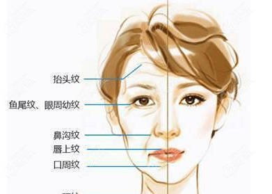 面部松弛做双平面提升脸部凹凸不平正常吗？