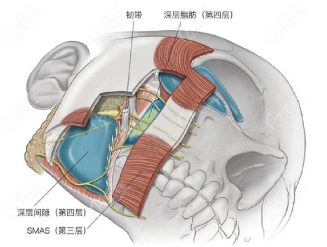 筋膜提升和埋线提升原理不一样