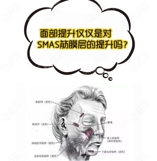 smas筋膜提升術(shù)真實感受