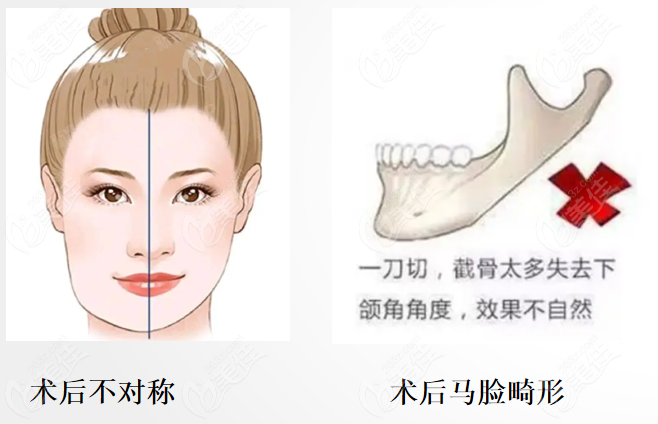下颌骨修复医生有哪些