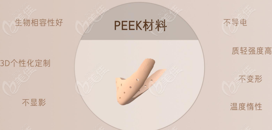 peek 3d打印人工骨材料修复下颌骨失败