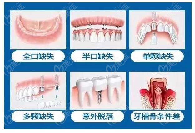 成都德道口腔收费价格贵吗