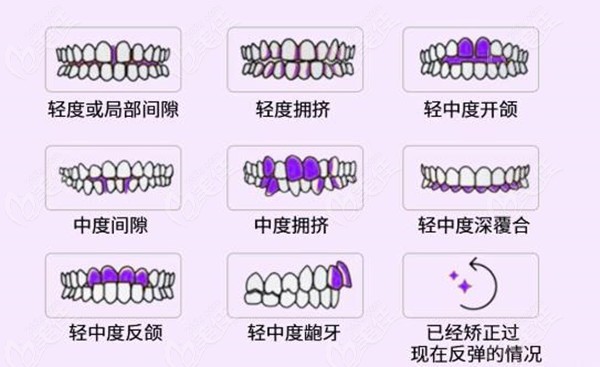 煙臺妍玉口腔牙齒矯正好不好