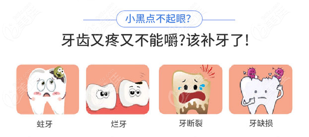 2023补牙价格是多少钱一颗