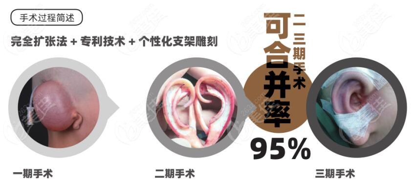 <!--<i data=20240703-sp></i>-->是国内小耳畸形出名的医生