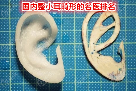 国内整小耳畸形的名医排名