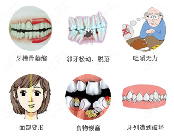 牙齿缺失的危害