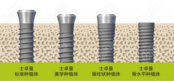 2023兰州瑞士种植牙价格是多少钱