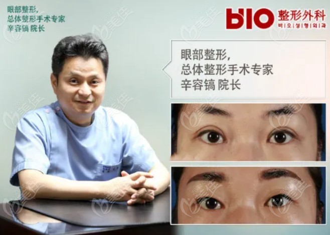 韩国bio辛荣镐修复双眼皮优势