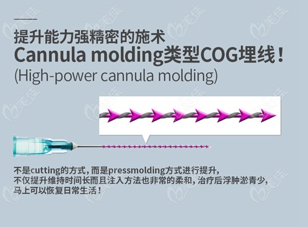 韓國美爾韓Cog V埋線提升 美佳網(wǎng)