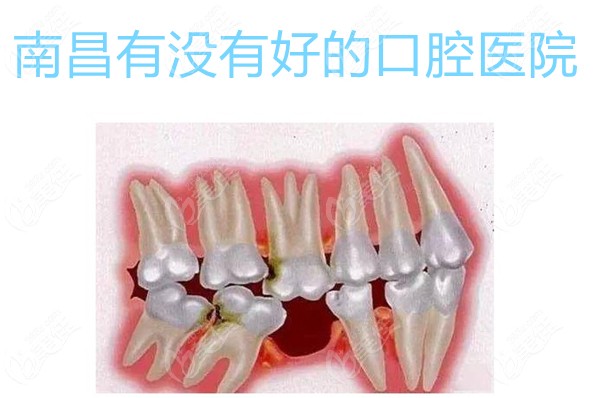 南昌有没有好的口腔医院