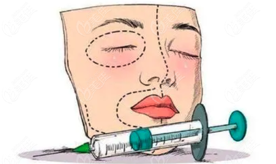 玻尿酸注射多久硬块可以消除呢