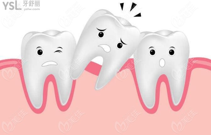 太原不同类型的牙齿拔除费用