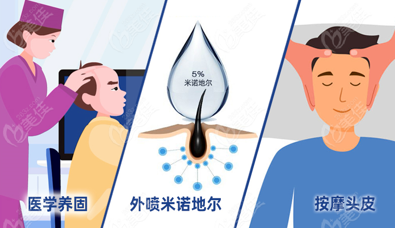 十大植发正规医院排行