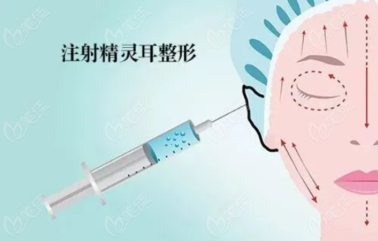 耳基底提升是不是精灵耳
