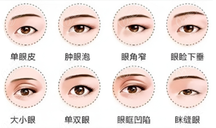<!--<i data=20240703-sp></i>-->浦东新区眼修复价格