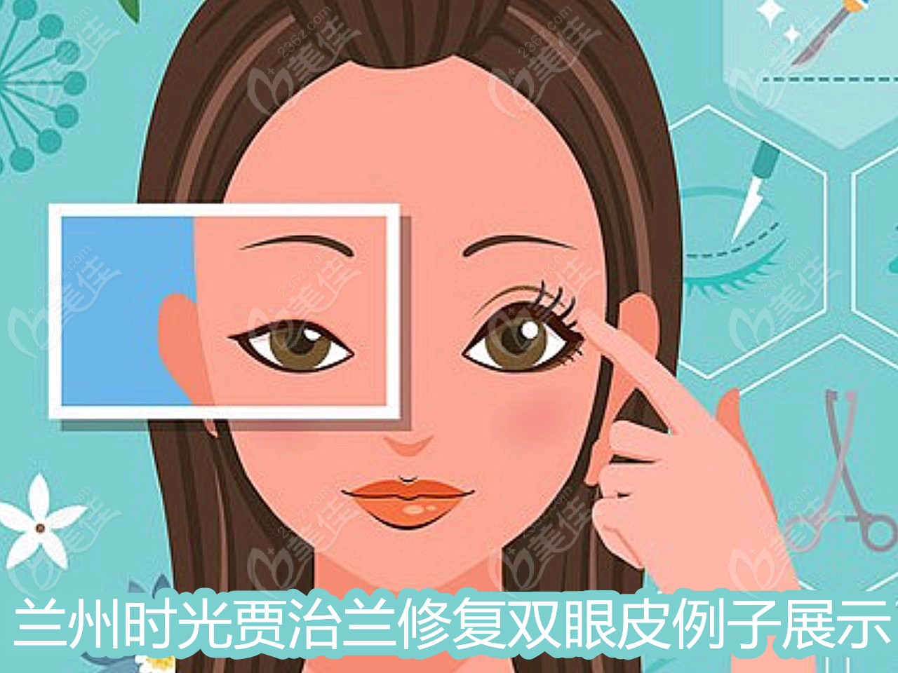 兰州时光贾治兰修复双眼皮例子