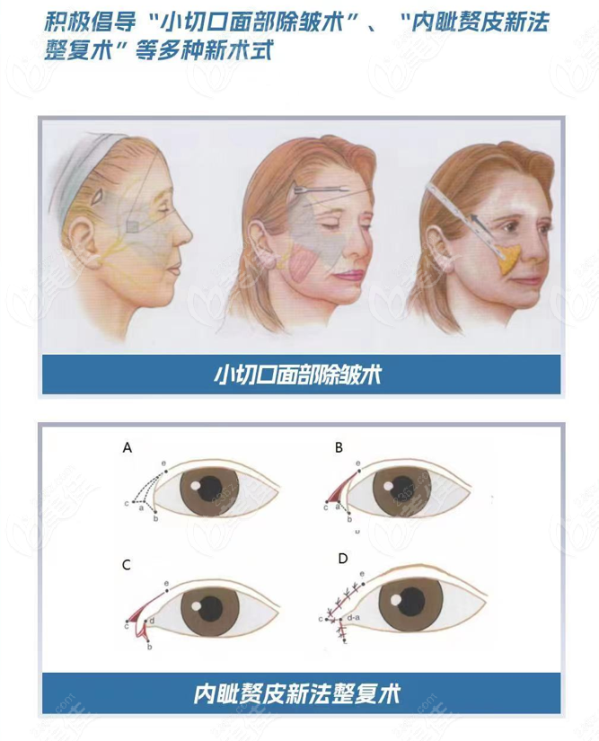 上海颜大夫董雷医生微拉美提升和内眼角修复怎么样