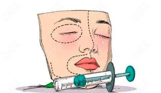 公主玻尿酸到底怎么样 公主玻尿酸到底怎么样