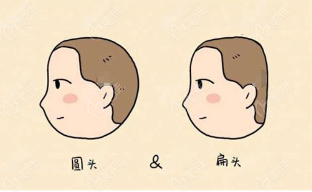 上海时光扁头变圆头整形手术多少钱