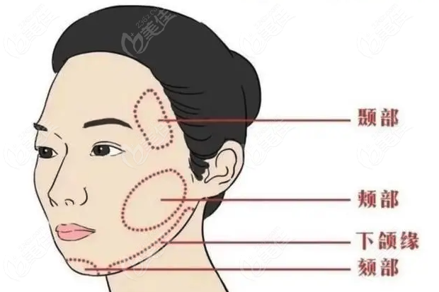 轮廓固定怎么做www.236z.com