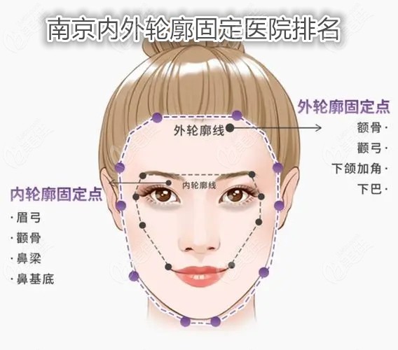 南京内外轮廓固定医院排名