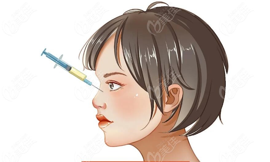 濡白天使隆鼻会变宽吗?不会 濡白天使隆鼻会变宽吗?不会