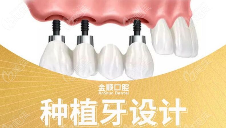 微创种植牙技术（种牙速度快）