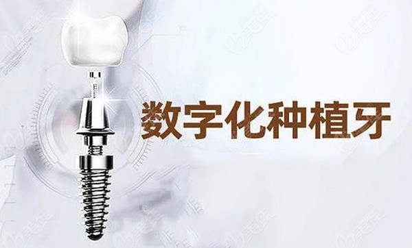 北京种植牙集采新消息236z.com