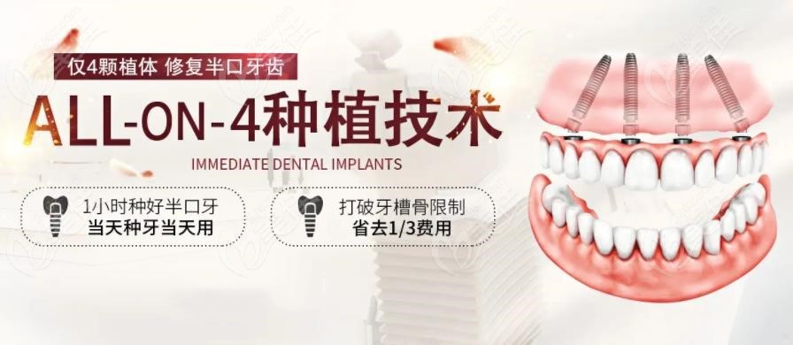 郫都区半口种植牙价格多少钱 郫都区半口种植牙价格多少钱