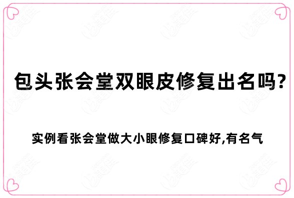 包头张会堂双眼皮修复出名吗