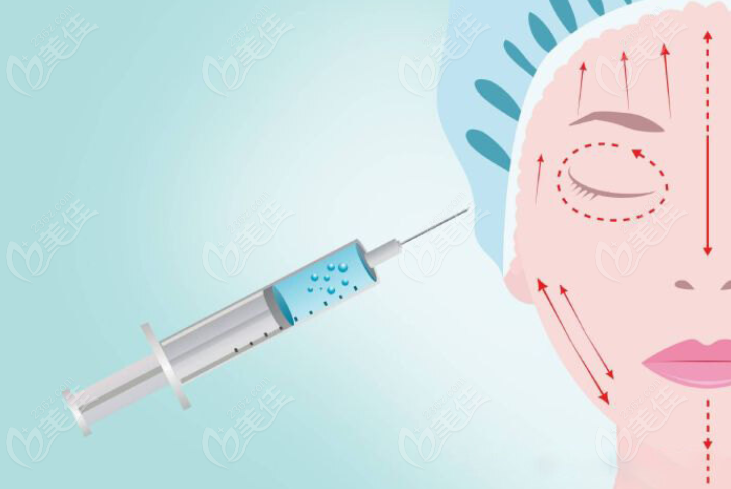 武汉注射玻尿酸好的医生可以打全脸