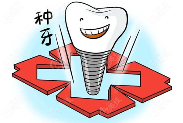 杭州牙科医院种植牙集采价格表