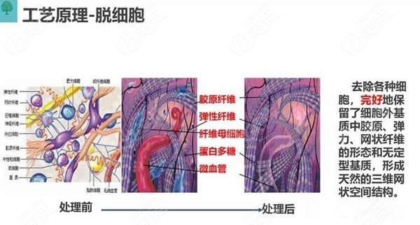 成都棕南医院私密优惠活动:3D生物束带缩阴术价格低至3.2折活动海报五