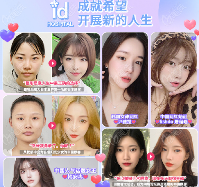 韓國id醫(yī)院李知赫醫(yī)生顴骨磨骨或面部輪廓三件套對比圖片