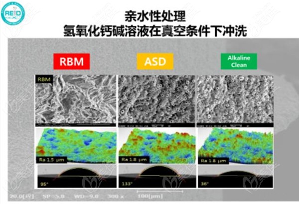 柯威尔亲水种植体的骨结合率好