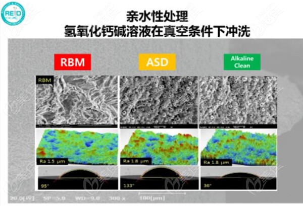 柯威尔亲水种植体的骨结合率好