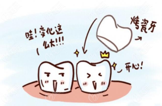 全瓷牙修复后的牙齿