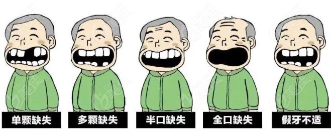 钦州粤桂时代口腔种植牙怎么样