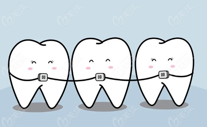 这是牙齿矫正卡通图www.236z.com