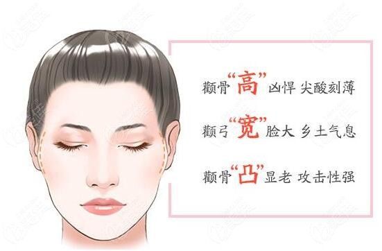 颧骨可以削吗