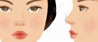 整形手术隆鼻多少钱 20230519_1684460658820492.png