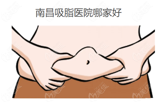 南昌吸脂医院哪家好